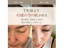 リノ(Lino)の雰囲気（私も肌に悩んだからこそ、寄り添う肌管理を大切にしています）