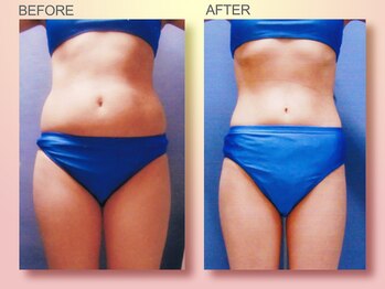 ジュリア オージェ 梅田店/ビフォーアフターエンダモロジー