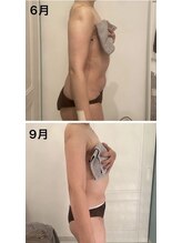 美人バスト 川崎店/【痩身・ダイエット】 腰回り