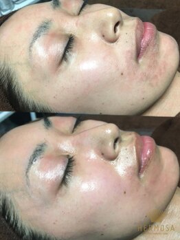 酵素浴サロン アールアール(R2)/