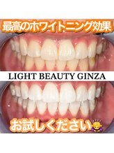 ライトビューティー 銀座店(LightBeauty)/東銀座 ホワイトニング 症例写真