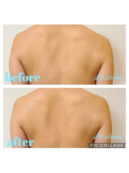 ラプレーヌ(La pleine)/