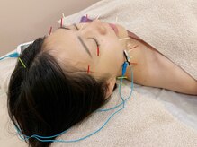 ロンルナール(Rond Renard)の雰囲気（一度でフェイスラインの変化を実感！）