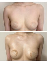 ルナグランデ 心斎橋店(Luna grande.)/他サロンで効果がなくても実感