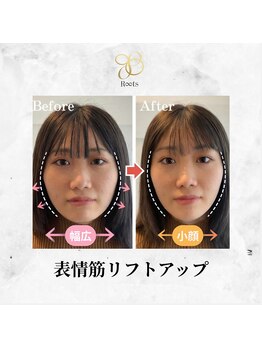 ルーツ(R∞ts)/衝撃ビフォーアフター