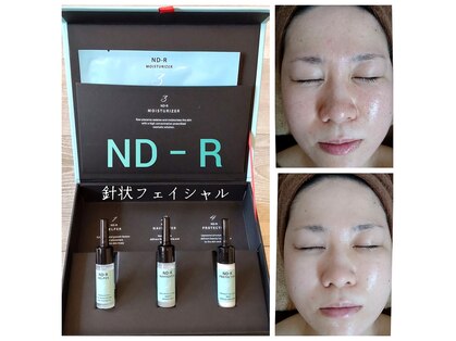 ボディーセラピーの写真