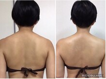 サロン ジョリー(Salon Jolie)/うもれてた首も、華奢首へ♪