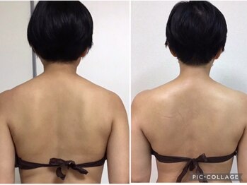 サロン ジョリー(Salon Jolie)/うもれてた首も、華奢首へ♪