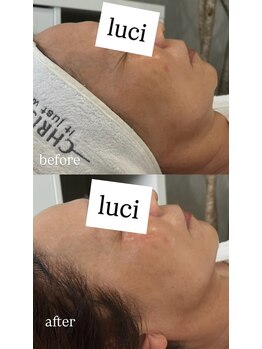 ビューティ スペース ルーチ(beauty space Luci)/クリスティーナbefore→after