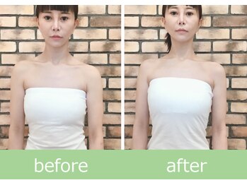 ひびきレディース整体 日吉/小顔×姿勢美で魅せる花嫁姿