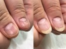 1人じゃ爪を伸ばせなかった