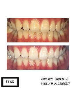 レオン 磐田(REON)/◇ お客様 before＆after ◇