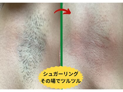 ディスイズミー シュガーリング(This is me Sugaring)の写真