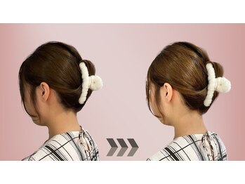 ココ(Coco)/うなじ脱毛