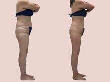 シェリートーキョー 成田店(Cherie Tokyo)/Before＆After /成田店