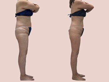 シェリートーキョー 成田店(Cherie Tokyo)/Before＆After /成田店