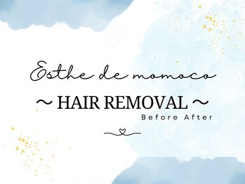 エステ ド モモコ/脱毛