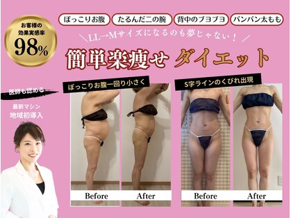 パピヨン(Papillon)の写真
