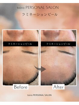 トイロ(toiro)/ラミネーションピール