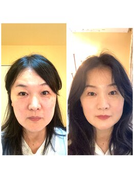 ハーボプラス(THE HEARBO plus)/ゴージャスフェイス