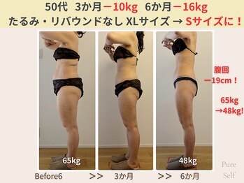 ピュアセルフ 新浦安(Pure Self)/【ビフォーアフター】