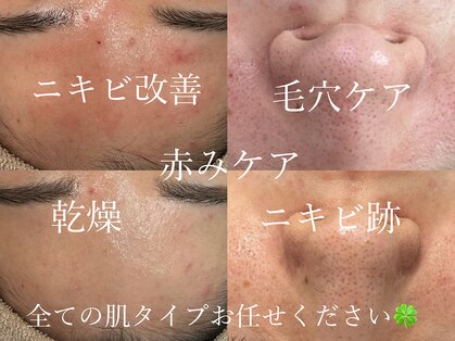 アンリミット 下北沢店(Une limit)の写真