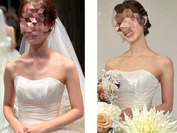 美骨矯正 ステキプロ(SUTEKI pro)の写真/ブライダル整体×痩身で、ドレス映えする美姿勢へ！背中・二の腕・肩甲骨まで徹底引き締め！！