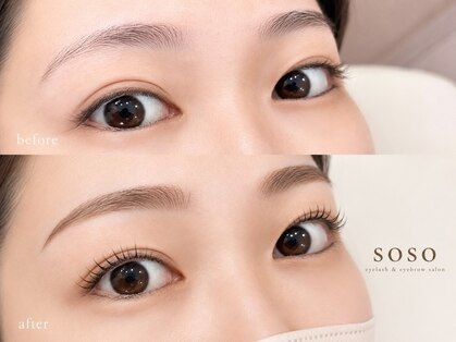 ソソ(soso)の写真