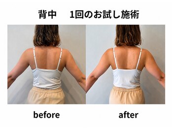 テクテク 鶴見駅西口店(TEQTEQ)の写真/ 背中とお腹をゆるめて、軽いカラダと美姿勢へ!