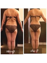 ウノジェンネ UNO DJENNE/たった3ヶ月で－7.1kg痩身!!30代