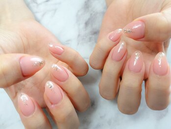 プレジール(Plaisir)/定額Aコース