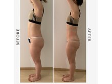 医療提携サロンの雰囲気（痩身ボディマシンで痩せやすい身体作りができます♪）