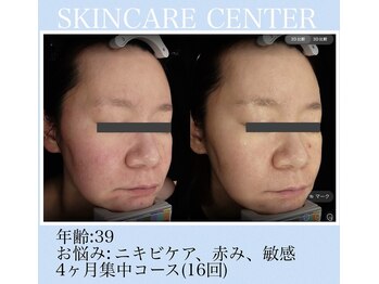 アンジェラックス スキンケアセンター心斎橋/