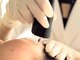 ニコリ(NICOLI)の写真/根本から肌質改善！ハイドロ毛穴洗浄☆ハーブピーリング☆プラズマニードル☆徹底アプローチ◎