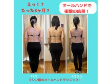 エルバード