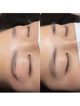 シャルコット(shall cocotte。)/ハリウッドブロウリフト