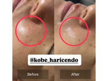 ハリシェンド/ハイドラ×WiQO