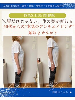 四条シセイ整体院(SHISEI整体院)/ビフォーアフター