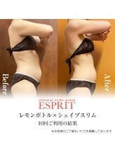 エスプリ 銀座店/レモンボトル痩身でお腹ペタンコ