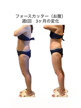ビーアイリー(Be irie)/痩身エステ フォースカッター