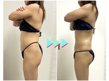 エスビーエス オキナワ(SBS OKINAWA)