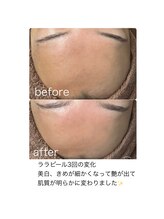 シエル ブルー(Ciel Blue)/肌質改善