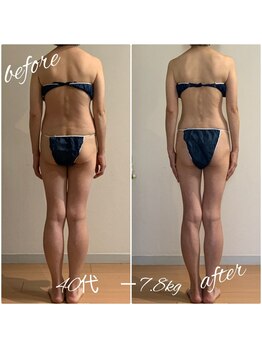 ヘルス＆ビューティークリニック　住美香（すみか）/ガチガチのお背中がスッキリ！