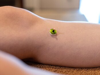 リゾート(Resort)/【ストレス緩和＊鍼灸】