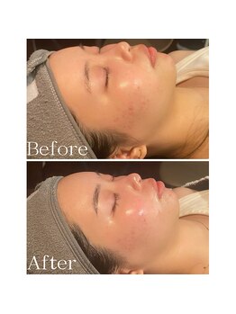 サロンドゥードゥー(SALON DOUDOU)/DOUDOUオリジナルここまで変わる