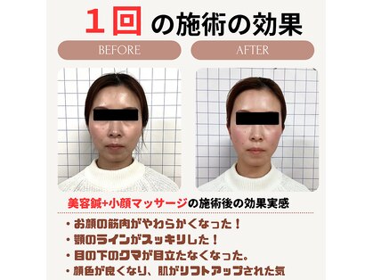 クローバー鍼灸整骨院の写真