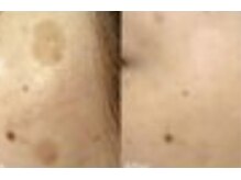 ファニービー 茨木店/Before→After