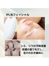 ロビナ(Lovina)/IPL光フェイシャル