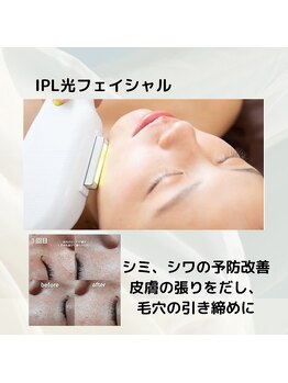 ロビナ(Lovina)/IPL光フェイシャル