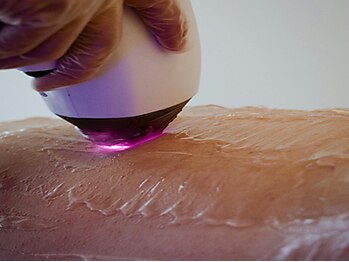 アマカ(Amaka)の写真/脱毛デビューはここで決まり！丁寧な初回カウンセリングであなたの悩みをしっかりサポートします☆